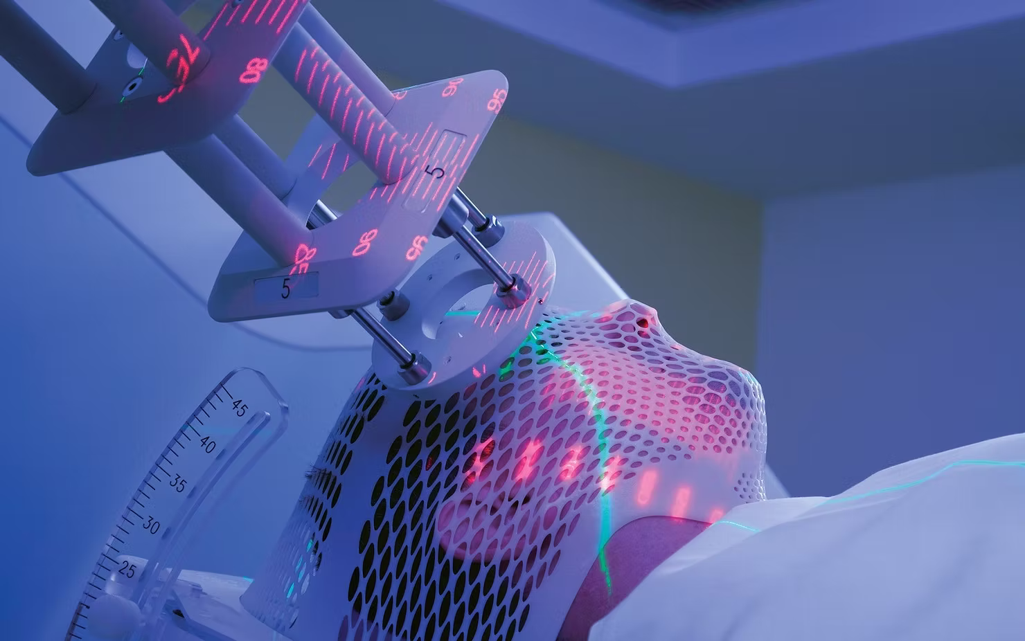 Radioterapia fulger (FLASH)