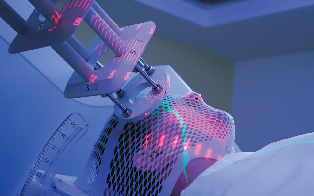 Radioterapia fulger (FLASH)